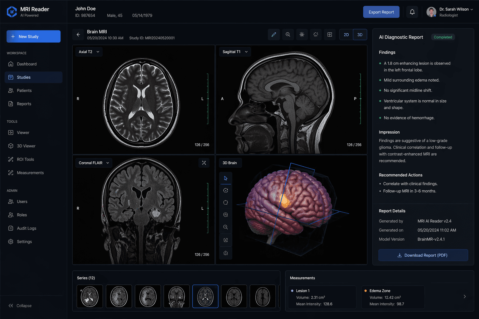 AI-assisted MRI analysis project